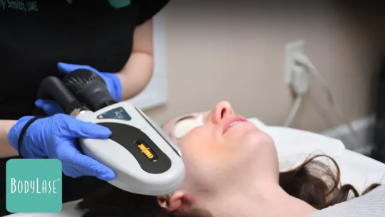 IPL Photofacial Raleigh NC