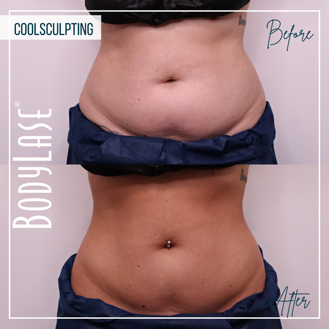 549681405-cs-b-a-abdomen-and-flanks-1