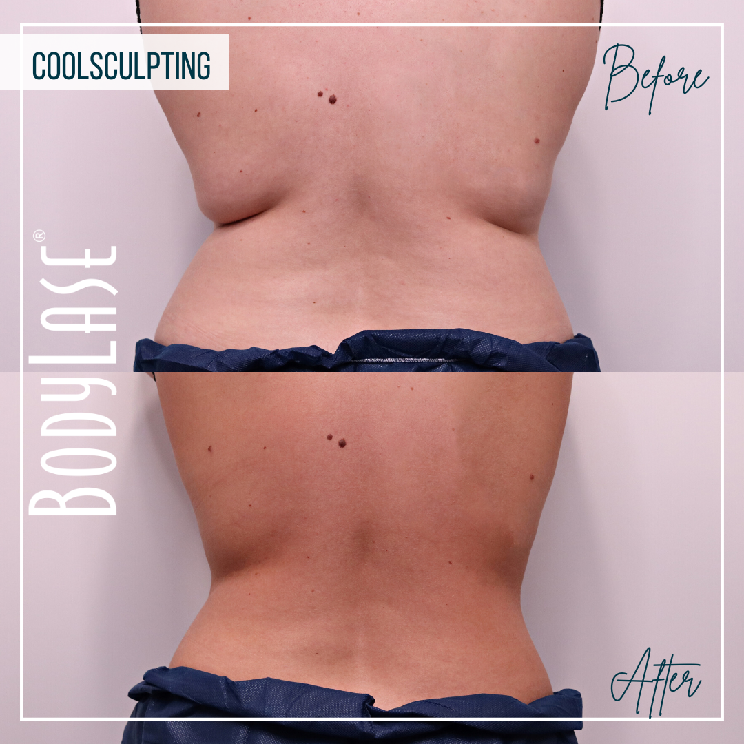 549681426-cs-b-a-abdomen-and-flanks-2