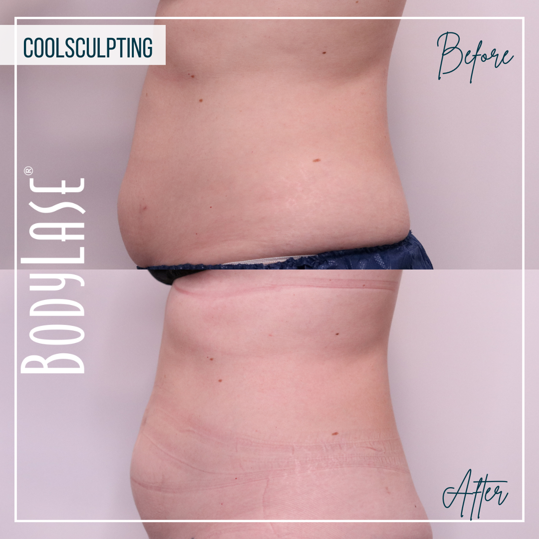 549681466-cs-b-a-abdomen-and-flanks-3