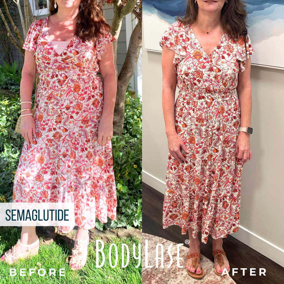 Semaglutide BodyLase B&A full
